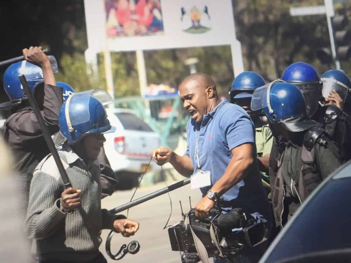 Pictures of a BBC Photo Journalist Attacked By Zimbabwe Police During Protest