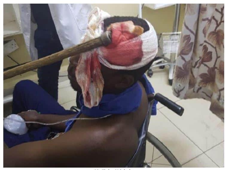 Picture: Zim man survives brutal axe attack