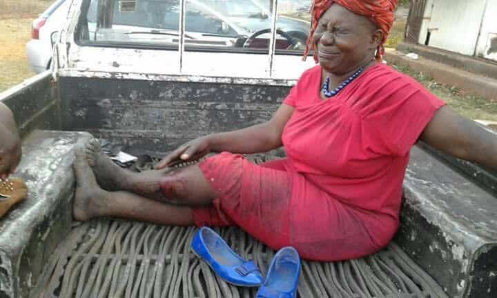 LATEST: Zanu PF supporters injured in Bulawayo succession violence..Pictures