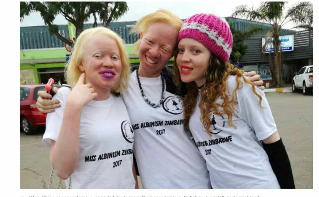 Miss Albinism Zimbabwe cancelled due to coup