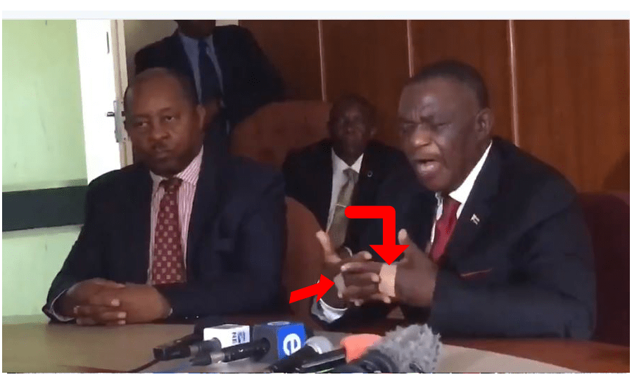 PICTURES: President Chiwenga wears bandages on both hands