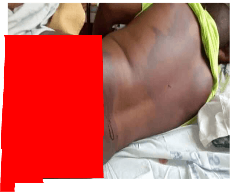 Mutare man savagely beaten by Zimbabwe soldiers dies from injuries