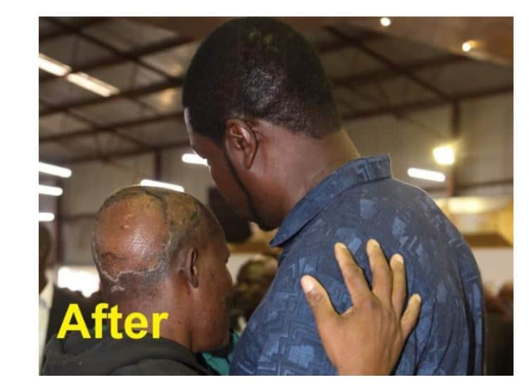 Shame On Prophet Magaya As Cancer Patient Gives Credit To Doctors Who Operated Him