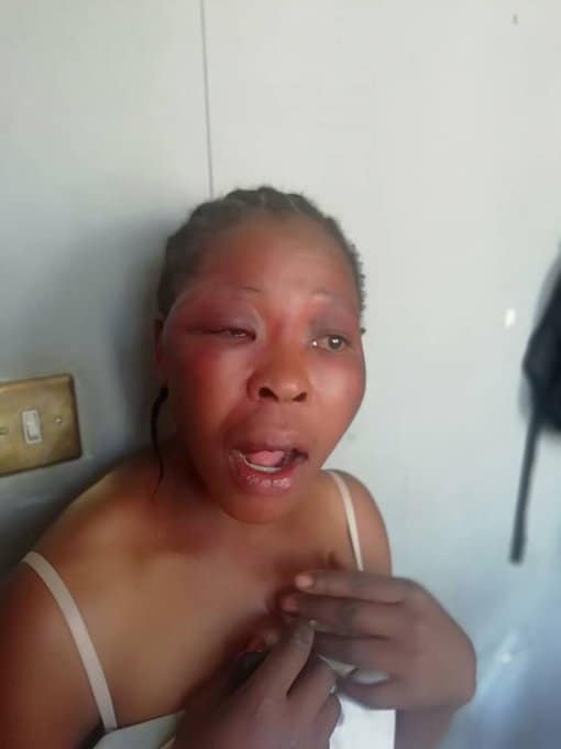 KWEKWE: MDC official viciously attacked by Zanu PF youths