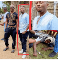 Harare: Mabhara’s brother shoots cheating girlfriend, himself on the mouth..PICTURES