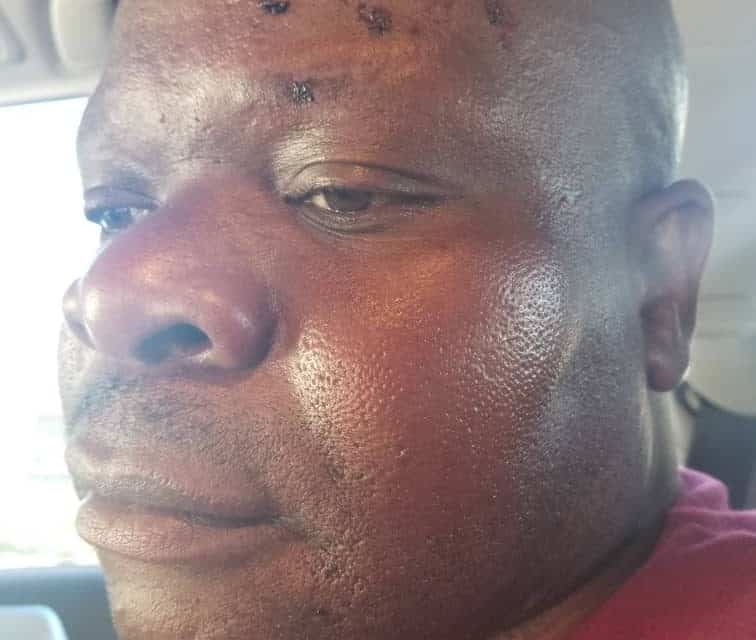 CIO Operative Blamed in MDC Alliance’s Amos Chibaya Accident… PICTURES
