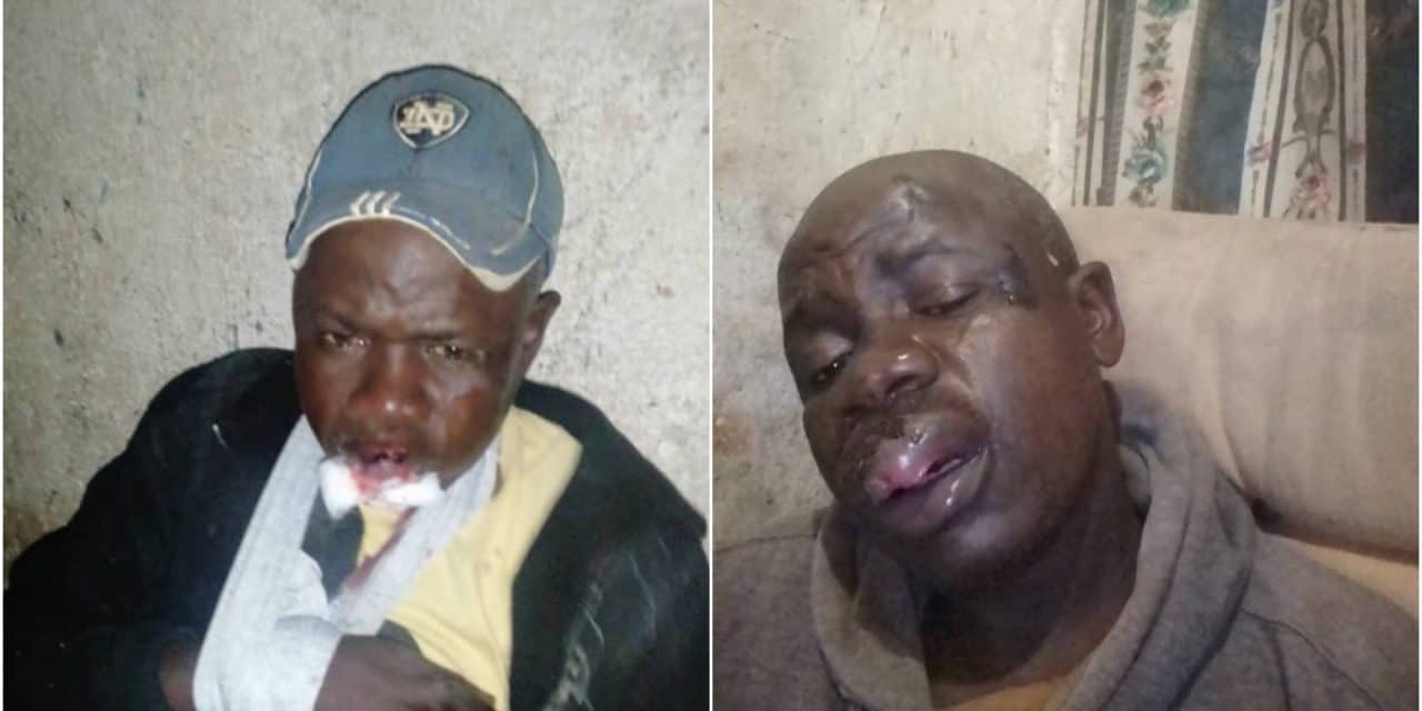 Harare Mabvuku man nearly killed by Zimbabwe soldiers over lockdown curfew