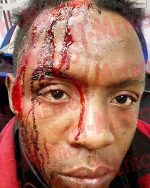Zimbabwean artist shot on face in South Africa