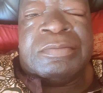 LATEST PICTURES: Victor Matemadanda poisoned at Zanu PF meeting, Ill in hospital….DETAILS