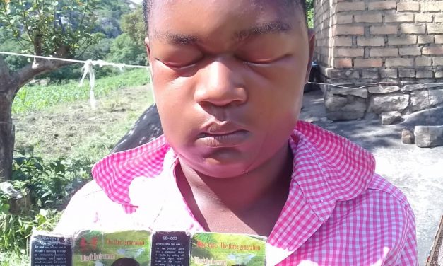 Zimbabwean woman goes blind after using Chinese-made hair dye….PICTURES
