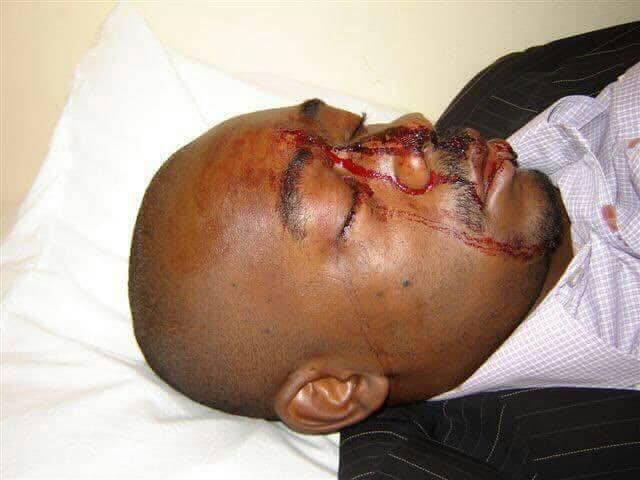 ‘I’d love to meet the woman who saved my life and thank her,’ Chamisa recalls day he survived ‘assassination attempt’…PICTURES…
