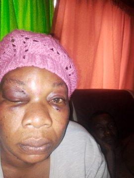 MDC-Alliance NEC member attacked by alleged CIOs- Party