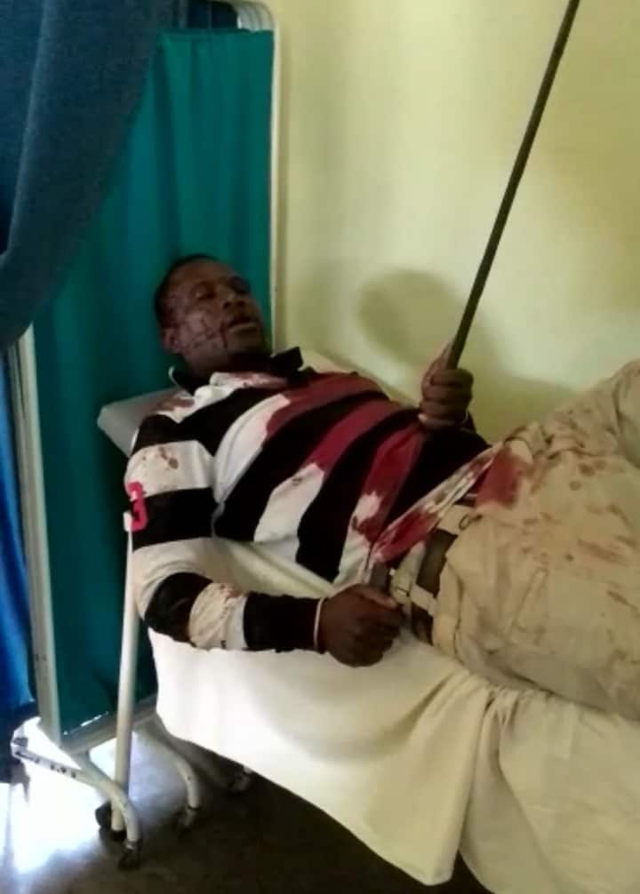 Illegal gold miner crawls into hospital with spear sticking in his chest