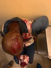 CCC vice president Tendai Biti’s home attacked, his security aide injured