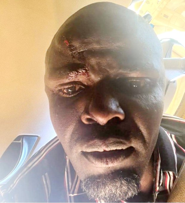 NAFJ condemns attack on journalists covering Chamisa’s rally in Gokwe