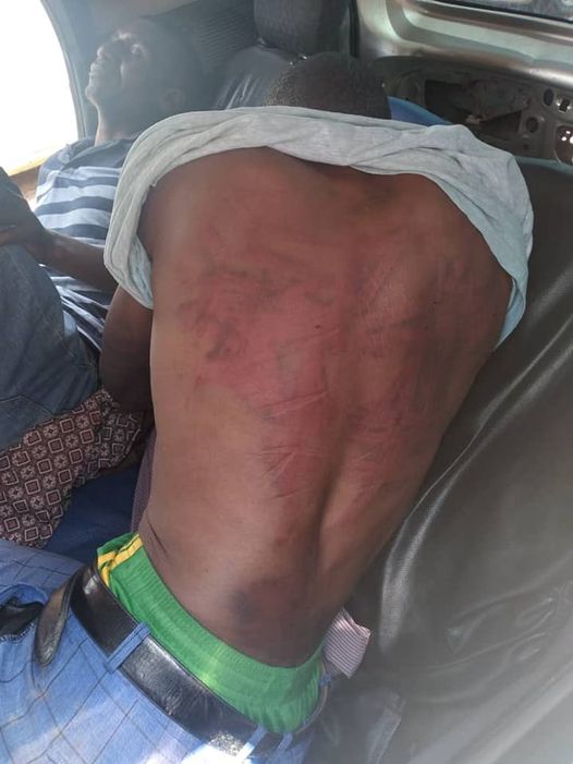 CCC activists abducted and beaten up on Thursday by suspected Zanu PF supporters